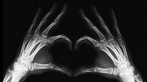 Image: X-ray of hands making a heart shape