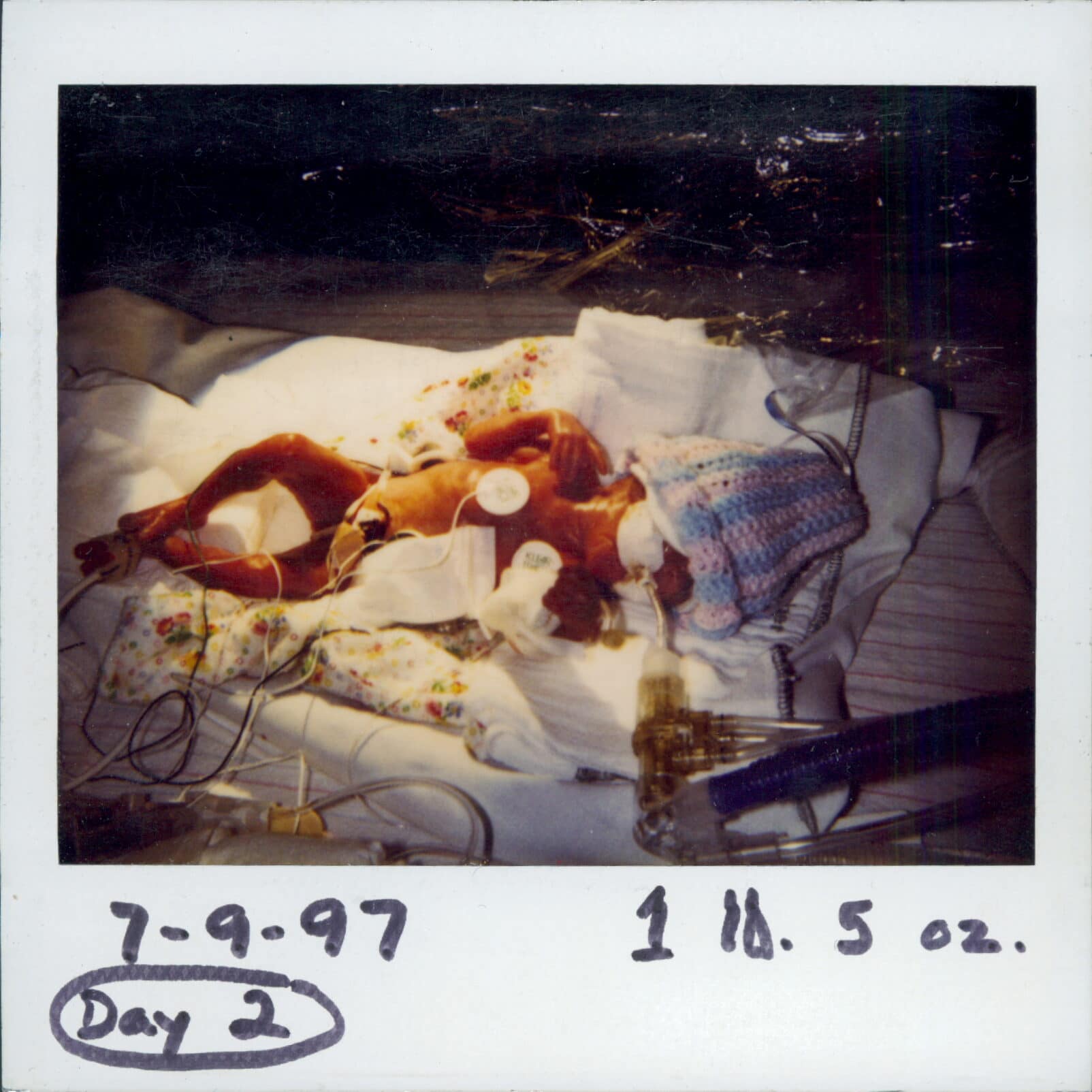 Image: Louisa in the NICU