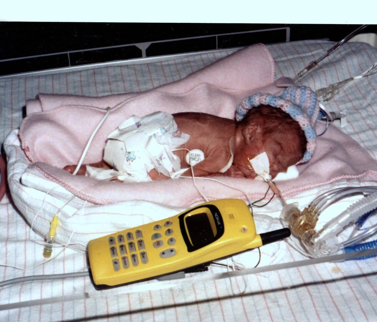Image: Louisa, micro-preemie, lying next to a cell phone at about the same size