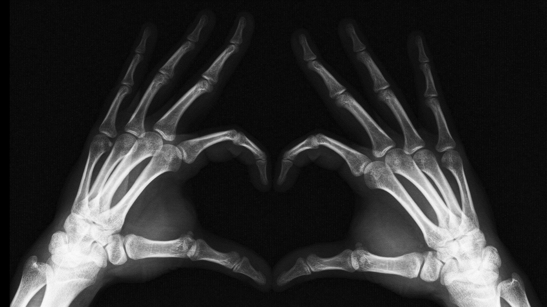 Image: X-ray of hands making a heart shape  out of the skeleton