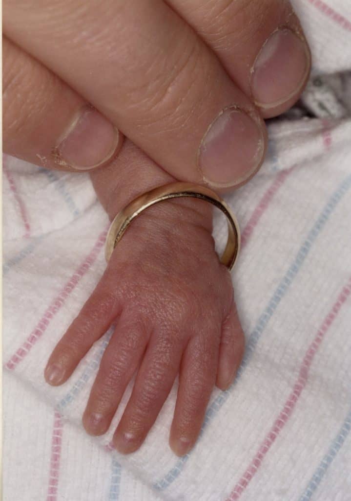 Image: Louisa's hand, with a wedding ring around her wrists
