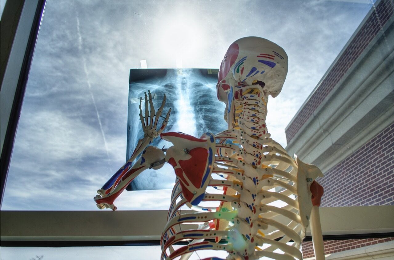 Image: Plastic skeleton holding an X Ray up to a window 